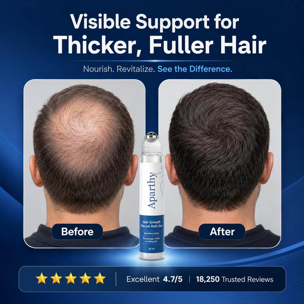 Aparthy Hair Growth Roll on Serum